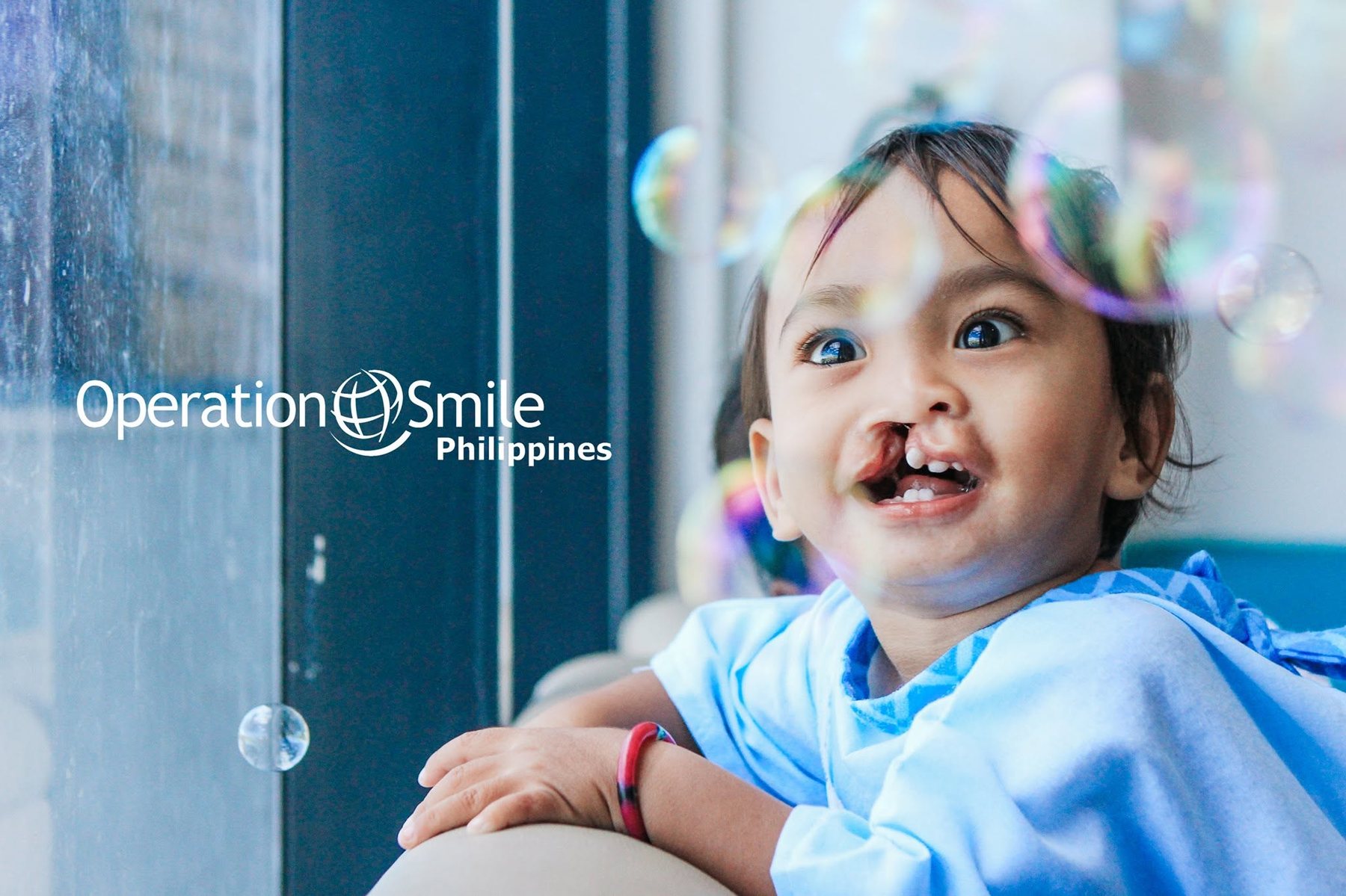A child helped by Operation Smile Philippines