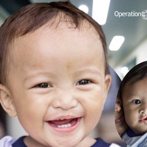 A smiling child helped by Operation Smile Philippines